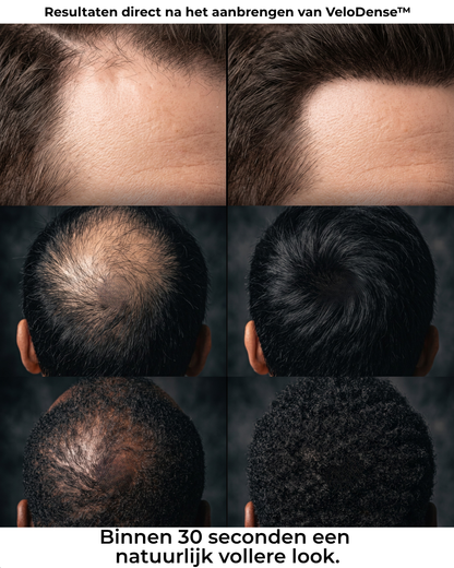 VeloDense™ | Een natuurlijk vollere look in 30 seconden.