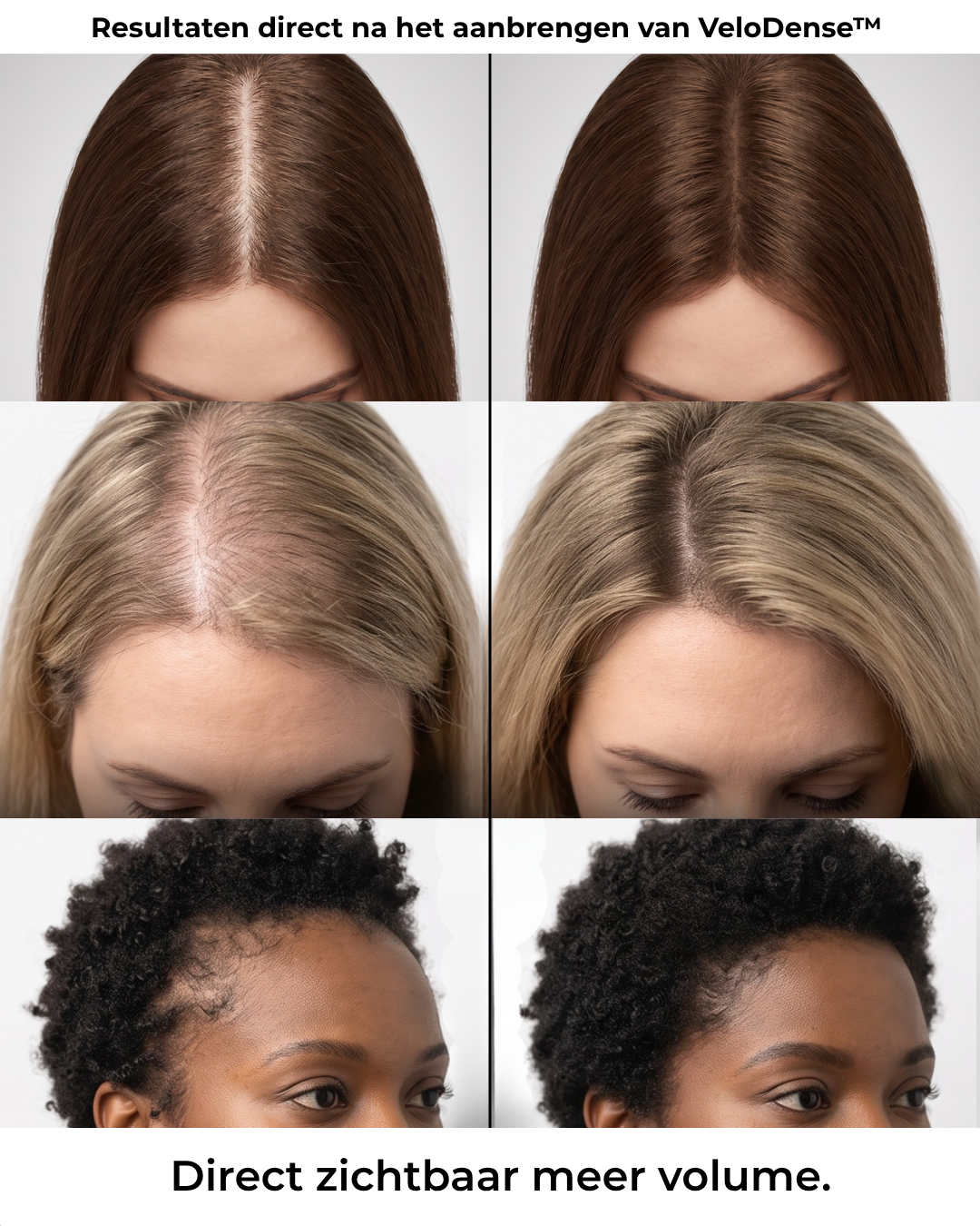 VeloDense™ | Een natuurlijk vollere look in 30 seconden.